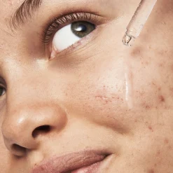 Blemish Breakthrough Triple-acid Resurfacing Serum