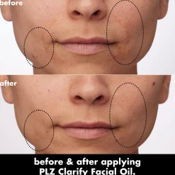 PLZ Clarify Facial Oil