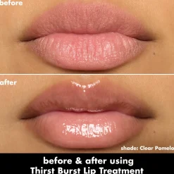 Thirst Burst Lip Treatment